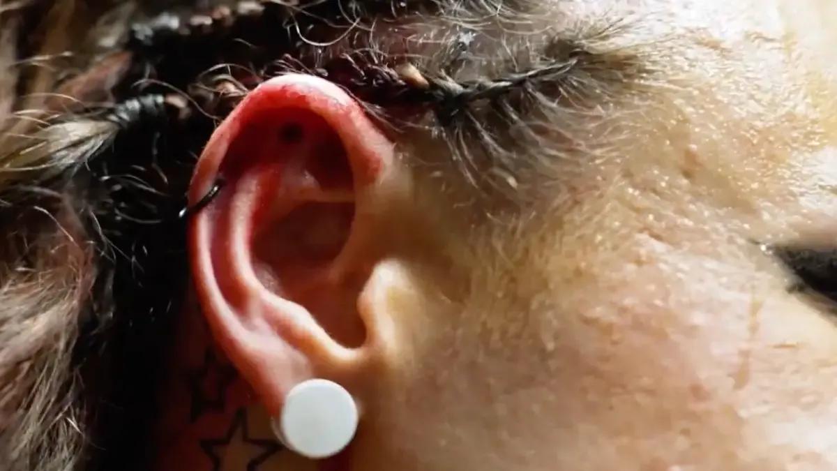 Jordynne Grace ear injury May 2024.jpg